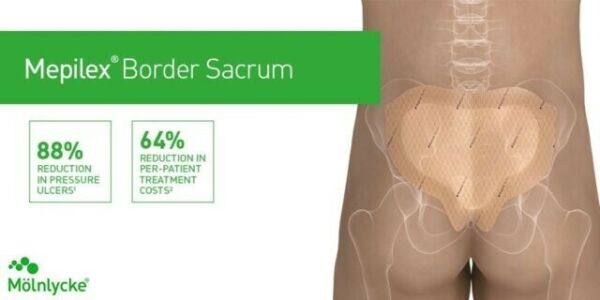 MÖLNLYCKE HEALTH CARE Mepilex Border Sacrum 16x20 Cm Sakral Basınç Ülseri Silikon Yara Örtüsü 1 Adet